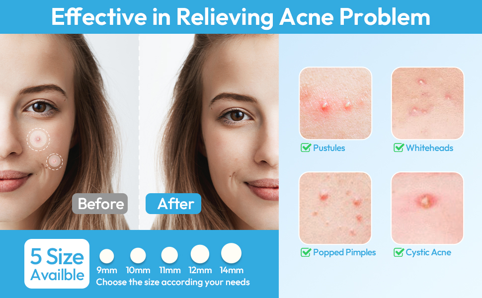 pimple patches