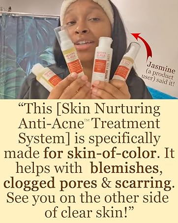 Skin Nurturing Anti-Acne System for Skin-of-Color Fights Acne Fades Spots Non-Drying Reduces Scar