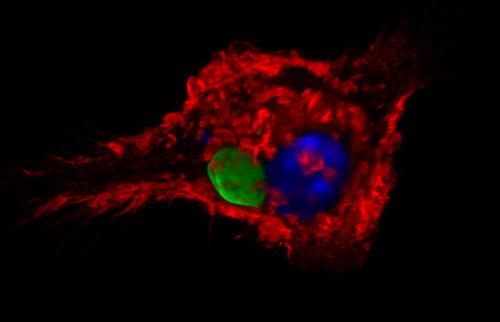 Interaction between the immune system and infectious diseases