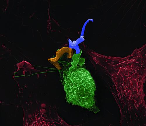 Liver immune cells